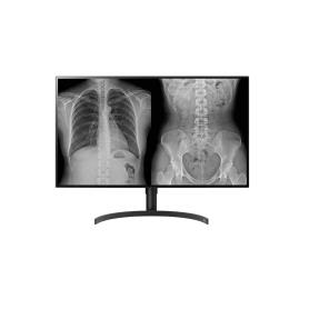 LG - Monitor IPS Medical UDH 32HL512D-B